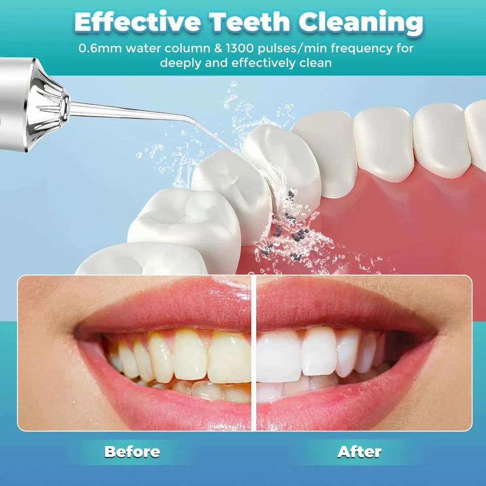🦷OralJet Pro™✨– Water Dental Flosser 🔥