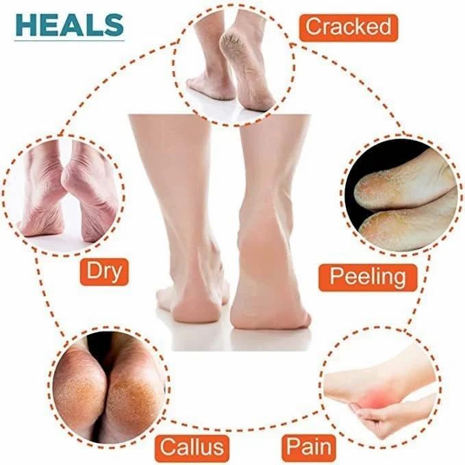 ✨SoftStep™ Gel Heel Socks